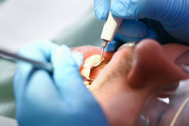 Best Pediatric Emergency Dentist in Buxton, NC