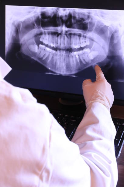 Best Emergency Dentist for Knocked-Out Tooth in Buxton, NC