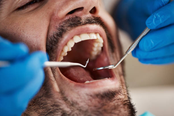 Best Emergency Dental Care for Abscessed Tooth in Buxton, NC